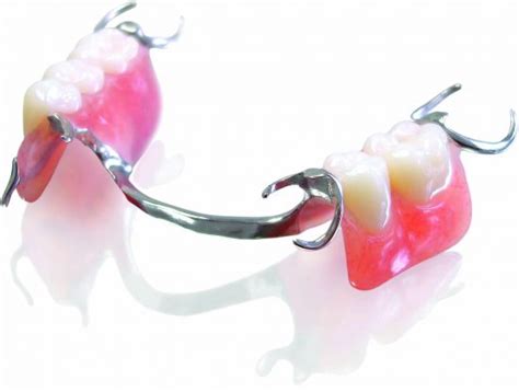 Partial Dentures - Gorey Denture Clinic