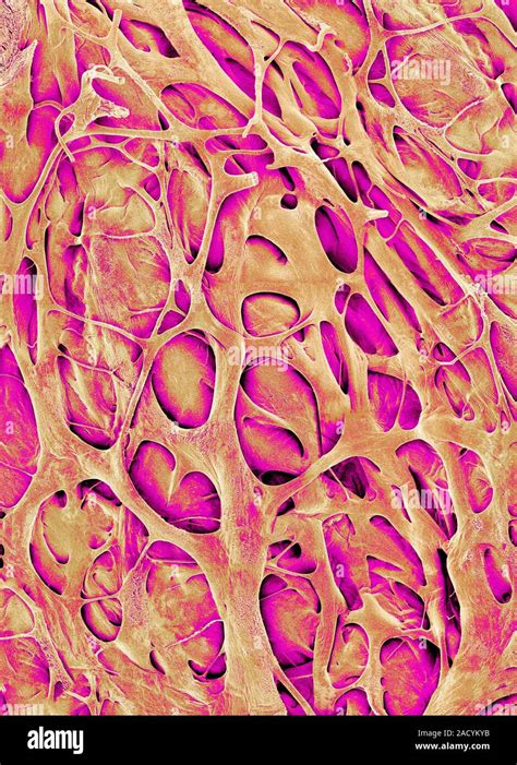 Trabeculae carneae in the right ventricle of the heart, coloured scanning electron micrograph ...