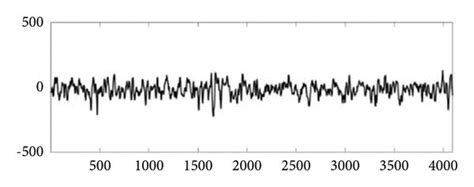 Sample of EEG signal from Bonn University dataset. (a) Class Z, (b ...