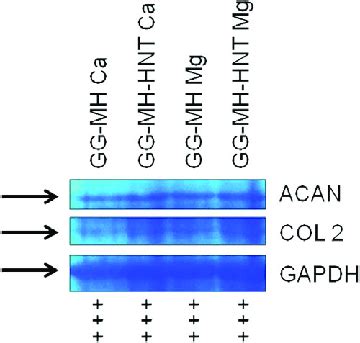 Coomassie blue staining after SDS-PAGE. | Download Scientific Diagram