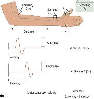 Nerve Conduction Study in Coimbatore | ID: 8412328791