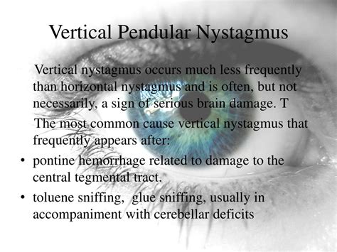 PPT - Nystagmus PowerPoint Presentation, free download - ID:1852222