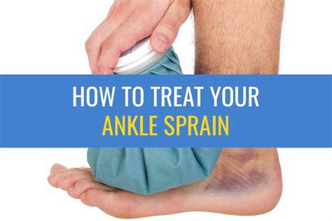 Ankle Sprain Treatment | Sprained Ankle Exercises | Sports Injury Physio