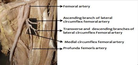 Medial Circumflex Femoral Artery Branches