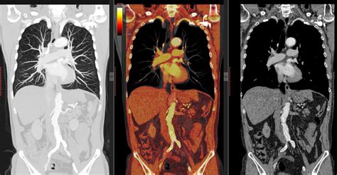 CT Scan Vs. PET Scan: What’s the Difference? — Radiology Associates of Ocala