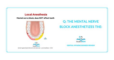 Q: The mental nerve block anesthetizes the: - StudentRDH Blog