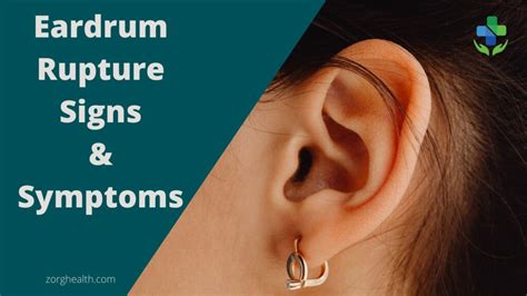 Ear drum Rupture Signs and Symptoms - Zorg Health