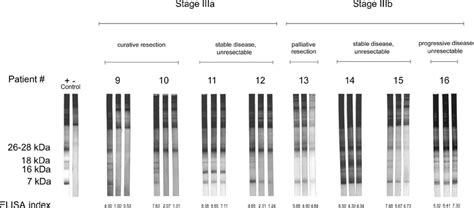 Western blot results for patients with AE in stages IIIa and IIIb ...