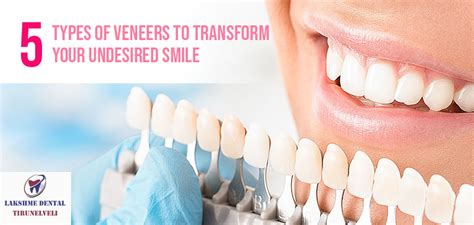 5 Types of Veneers to Transform Your Undesired Smile