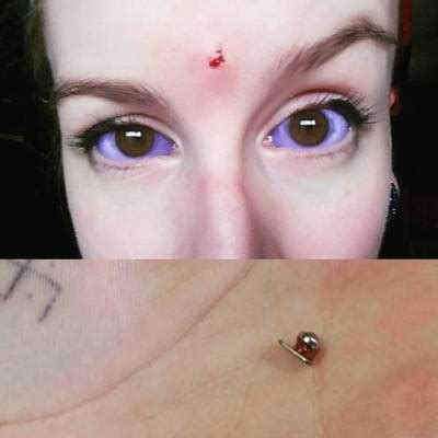 Eyeball Tattoo Removal - Wiki Tattoo