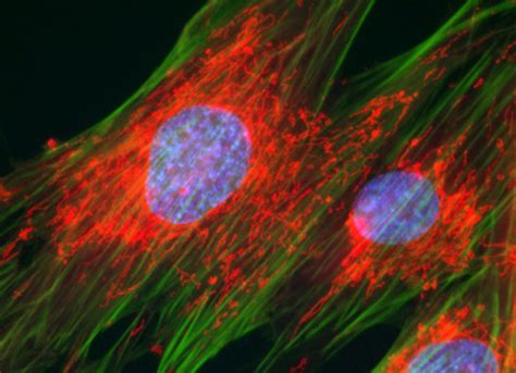 Human Lung Cells with DAPI, Alexa Fluor 488, and MitoTracker Red CMXRos ...