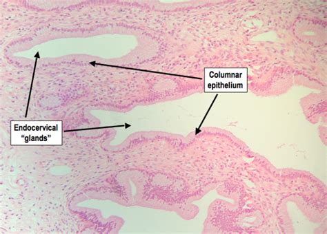 Cervix Histology Diagram