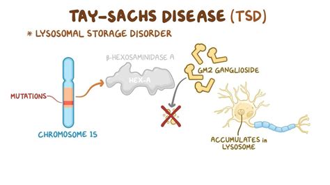 Tay-Sachs disease (NORD): Video, Anatomy & Definition | Osmosis