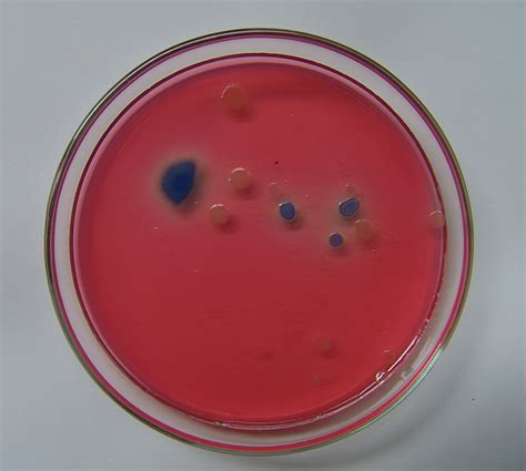 Free E.coli Stock Photo - FreeImages.com