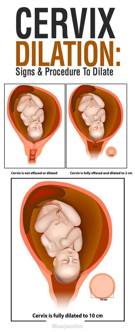 Cervix Dilation: Signs, And Procedure To Dilate | Cervix dilation ...