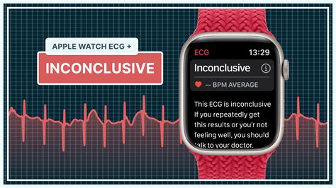 What Inconclusive ECG Means on Your Apple Watch | Qaly