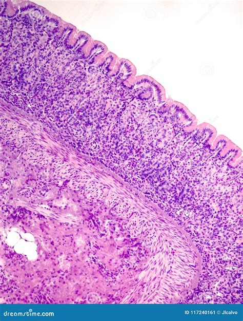 Stomach. Mucosa and Submucosa Layers Stock Image - Image of tract, system: 117240161