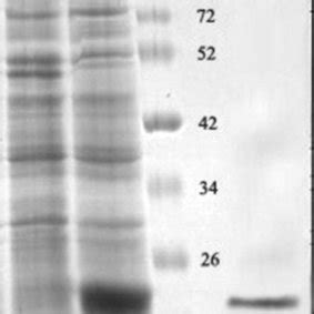 Coomassie Blue-stained SDS-PAGE gel showing the expression and... | Download Scientific Diagram