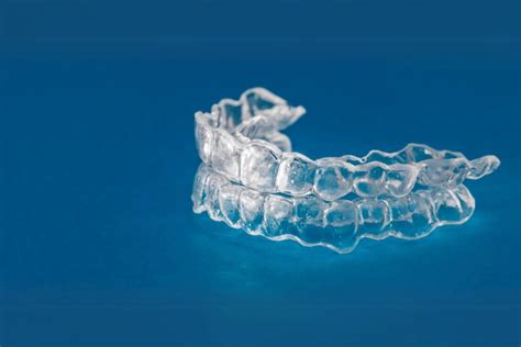 Braces vs. Aligners: Decoding the Key Differences – Aligner32