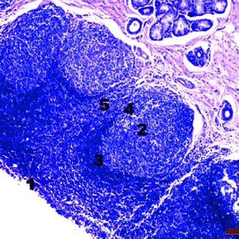 (PDF) Histology and scanning electron microscopy of the tubal tonsil of ...