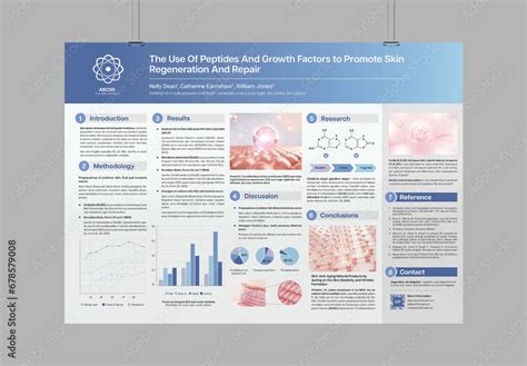 Case Study Research Poster Layout Stock Template | Adobe Stock