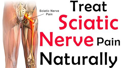 Alternative Medicine For Sciatica Nerve Pain - MedicineWalls