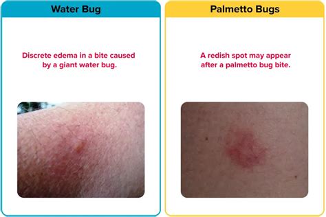 Palmetto Bug Vs. Water Bug [15 Differences] | APB