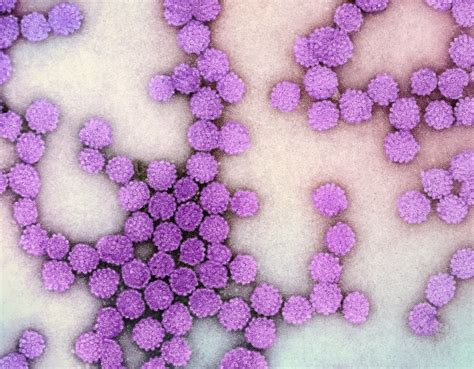 Bacterial Infections Quiz