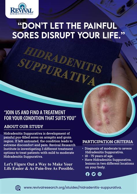 Hidradenitis Suppurativa Clinical Trials