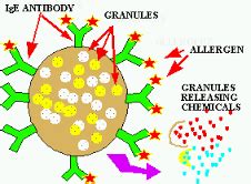 elevated ige - Los Angeles Allergist