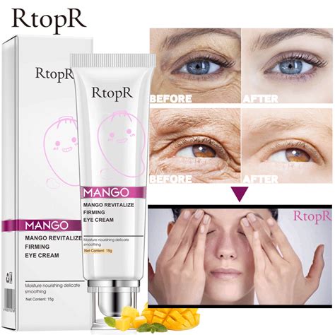 Mango Anti Winkles Eye Cream Skin Care Anti Puffiness Dark Circle Anti ...