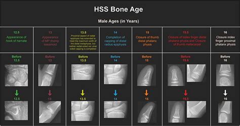 Bone Color Chart