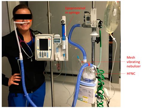 High Flow Nasal Cannula