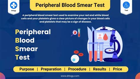 What is a Peripheral Blood Smear normal report?