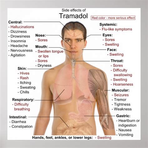 Side Effects Chart for Tramadol Hydrochloride Poster | Zazzle