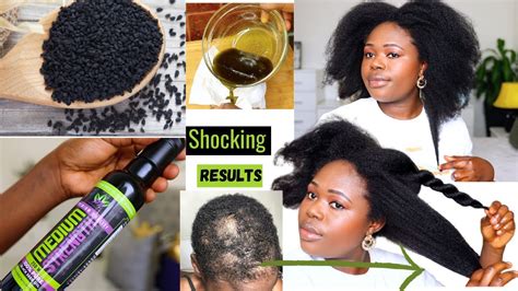 Can I Apply Black Seed Oil On My Hair Cheap Clearance | prepagoslatinas.com