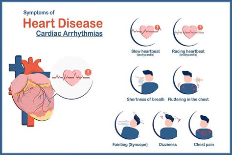 Heart Arrhythmia: A Comprehensive Guide - Longmore Clinic