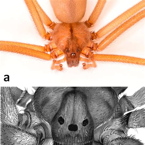 Clinical picture of a child bitten by a Loxosceles spider in... | Download Scientific Diagram