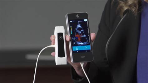 GE Vscan Extend Handheld Portable Ultrasound - Pramana Asigo CV - ecplaza.net