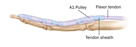 Flexor Tendon Sheath