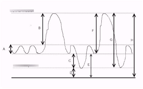 Lung volume Diagram | Quizlet