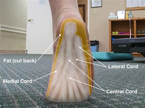 Plantar Fascia Anatomy