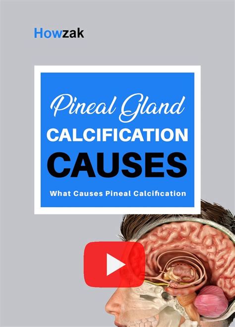 Pineal Gland Calcification Cause | What Causes Pineal Calcification? | Pineal gland, Gland, Diy ...