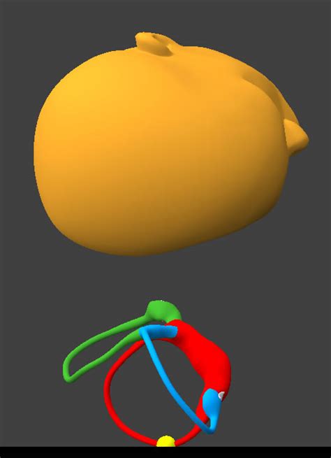 Lateral Canal BPPV -- Gufoni for ageo