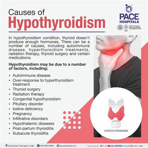 Hypothyroidism