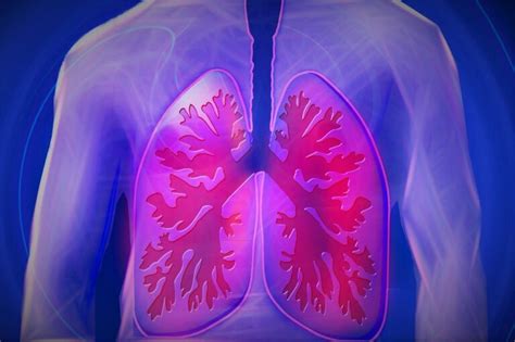 Four stages of COPD - Global Allergy & Airways Patient Platform