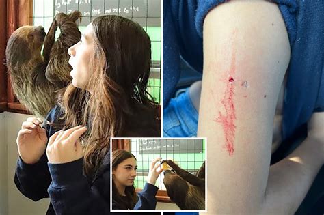 Ithaca woman attacked by rabid fox: video