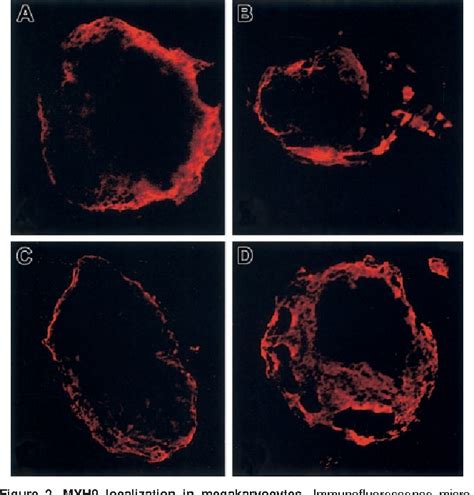 Figure 2 from for the phenotypes in May-Hegglin anomaly / Fechtner syndrome mutation results in ...