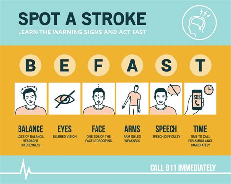 Be Stroke Smart and “BE FAST”! - Alameda Health System