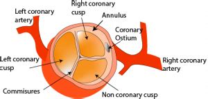 Aortic valve anatomy - Critical Care Sonography